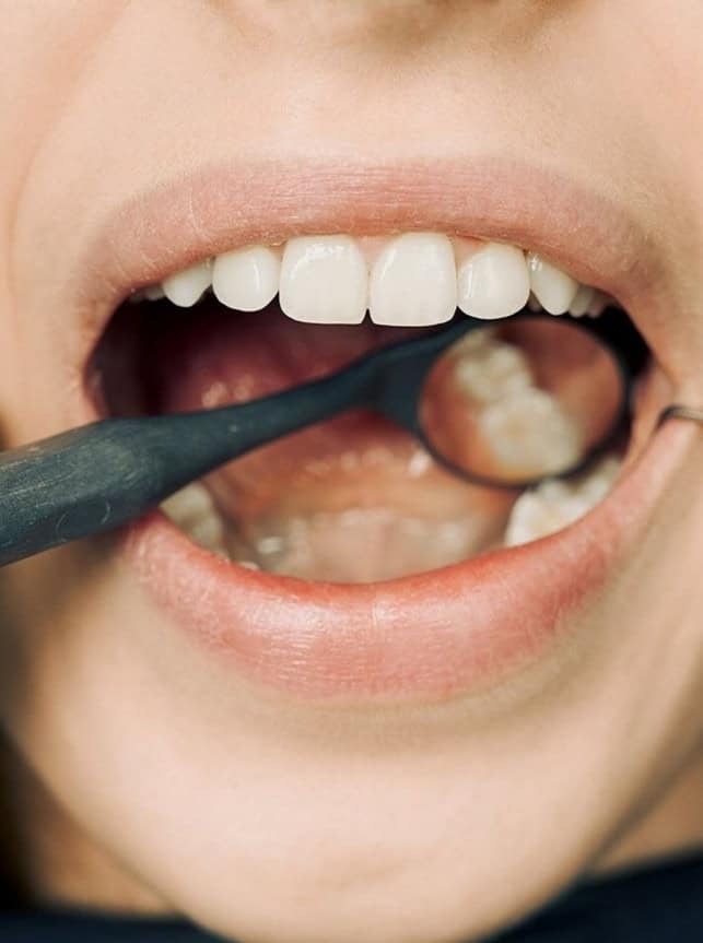 trattamentistudiodentisticobrillante (2) trattamenti studio dentistico brillante